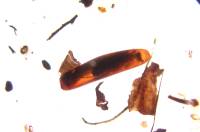 Chrostik Rhyacophila kukla P9280038 