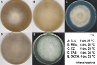 Četné chlamydospory ve vzdušném myceliu (MEA, kys. mléčná, DIC, 400x)