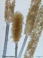 Mycotypha microspora CCF 1876, sporofory
