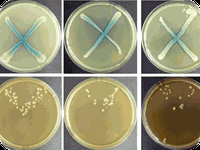 Bacillus subtilis - detekce mutátorů (metody)