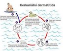 Helmintologové mapují výskyt cerkáriové dermatitidy