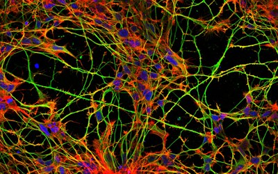 Neurony_cytoskelet.jpg