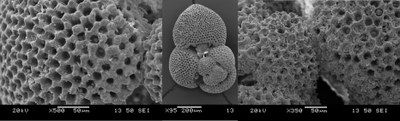 Foraminifera pod elektronovým mikroskopem